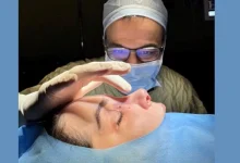 دکتر مفرد جراح بینی